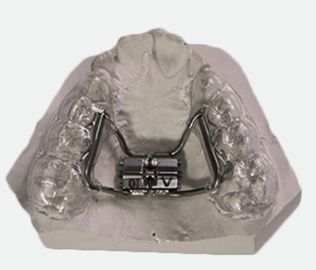 Disjoncteur orthodontique