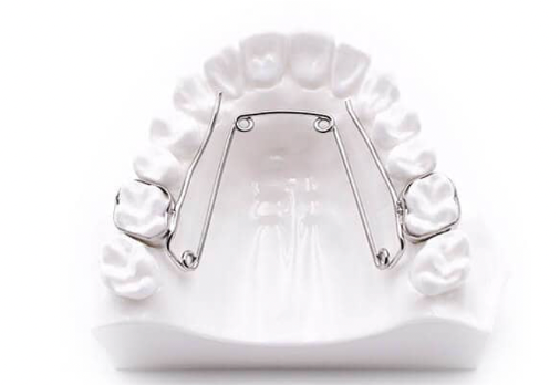 Quad-hélix orthodontique