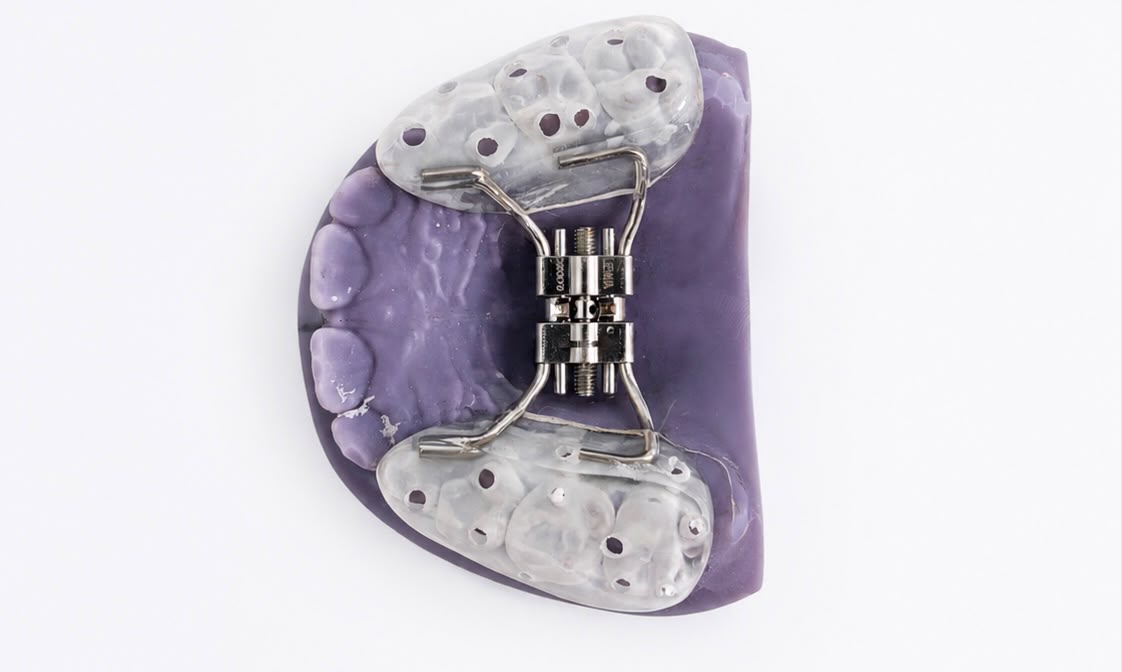 Bilan et orthodontie interceptive précoce