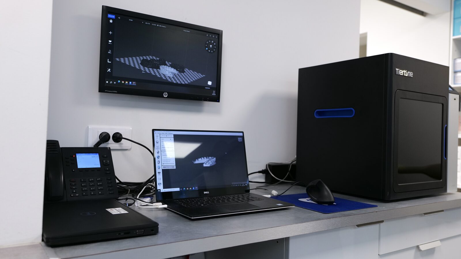 Recherche en ancrage orthodontique, scanner 3D